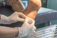 Non-Diabetic Foot Ulcers